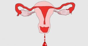 أسباب توقف نزول الدم أثناء الدورة