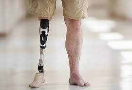 أعراض-ارتفاع-السكر 