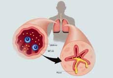 أعراض نقص المغنيسيوم عند الأطفال و اضرار زيادته أعراض-نقص-المغنيسيوم-عند-الأطفال