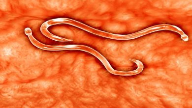 اعراض الديدان الدبوسية عند الكبار اعراض الديدان الدبوسية عند الكبار