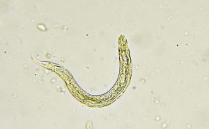 اعراض الديدان الدبوسية عند الكبار	