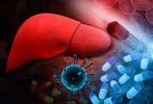 تضخم الكبد الأسباب والأعراض وعلاجة النهائي تضخم-الكبد