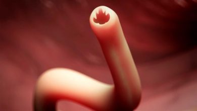 علاج ديدان البطن علاج ديدان البطن