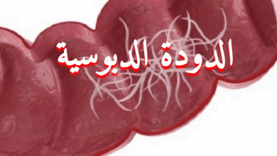 علاج الديدان الدبوسية  علاج الديدان الدبوسية