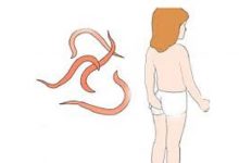 علاج-الديدان-للأطفال