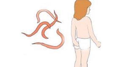 علاج-الديدان-للأطفال
