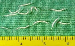 علاج ديدان المهبل عند النساء علاج ديدان المهبل عند النساء