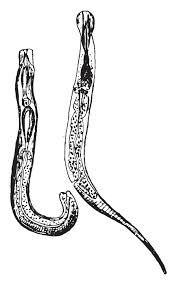 علاج ديدان المهبل عند النساء علاج ديدان المهبل عند النساء