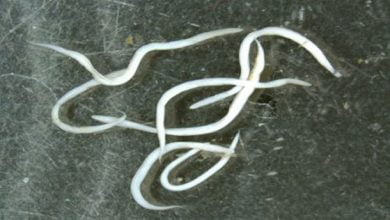 علاج ديدان المهبل عند النساء