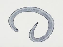 علاج ديدان المهبل عند النساء علاج ديدان المهبل عند المهبل