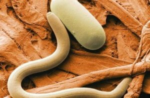 علاج ديدان المهبل عند النساء علاج ديدان المهبل عند النساء