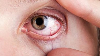 ماهو  داء ويلسون؟ ماهو  داء ويلسون؟