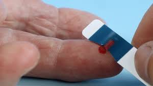 مرض-الكبد-الوبائي