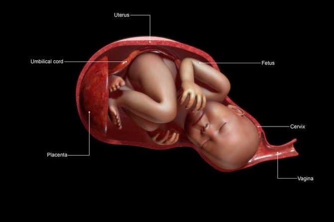 أنواع الولادة المبكرة