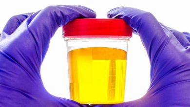 أسباب زيادة اصفرار البول أسباب-زيادة-اصفرار-البول