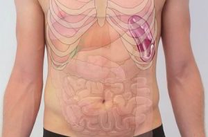 أعراض تضخم الطحال