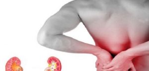 علاج الطرد الطبي