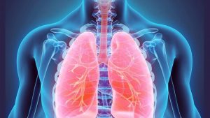أعراض-سرطان-الرئة