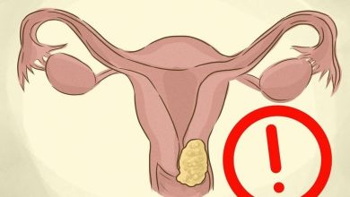 أعراض سرطان الرحم وأسبابه أعراض-سرطان-الرحم