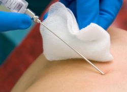 أعراض سرطان الكبد وطرق الوقاية منه أعراض-سرطان-الكبد