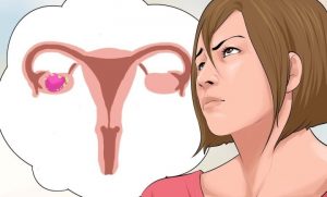أعراض سرطان المبيض و الرحم أعراض-سرطان-المبيض