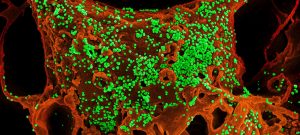 أعراض فيروس كورونا أعراض- فيروس- كورونا