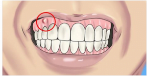 أعراض نقص الكالسيوم أعراض-نقص-الكالسيوم