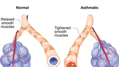 علاج الربو علاج-الربو