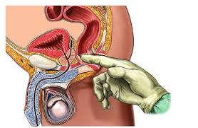 علاج تضخم البروستاتا علاج-تضخم-البروستاتا