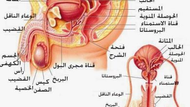 علاج-تضخم-البروستاتا