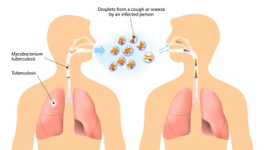 ما هو الدرن