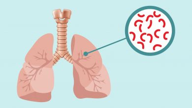 مرض الدرن المعدي مرض-الدرن