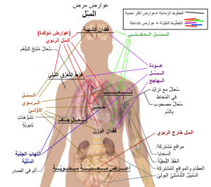 مرض الدرن المعدي مرض-الدرن