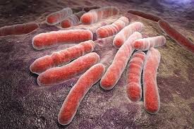 مرض الدرن المعدي مرض-الدرن