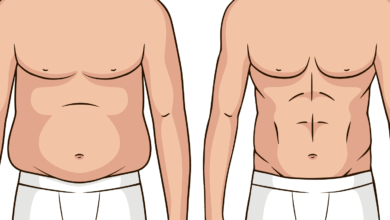 عمليات تجميل البطن المترهل عمليات تجميل البطن المترهل