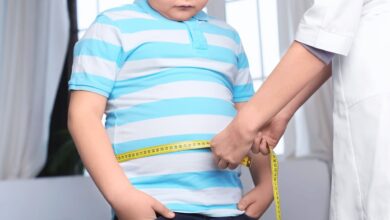 تكميم المعدة للأطفال