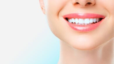 أنواع عمليات تجميل الاسنان أنواع عمليات تجميل الاسنان