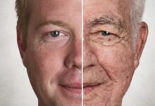 نسبة فشل عمليات التجميل