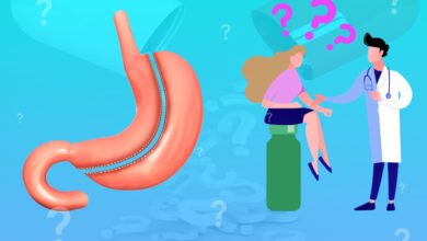 مخاطر عملية تكميم المعدة مخاطر عملية تكميم المعدة