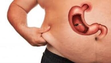 تدبيس المعدة بطريقة طبيعية تدبيس المعدة بطريقة طبيعية