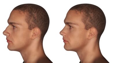 ما هي أضرار عمليات تجميل الأنف أضرار عمليات تجميل الأنف